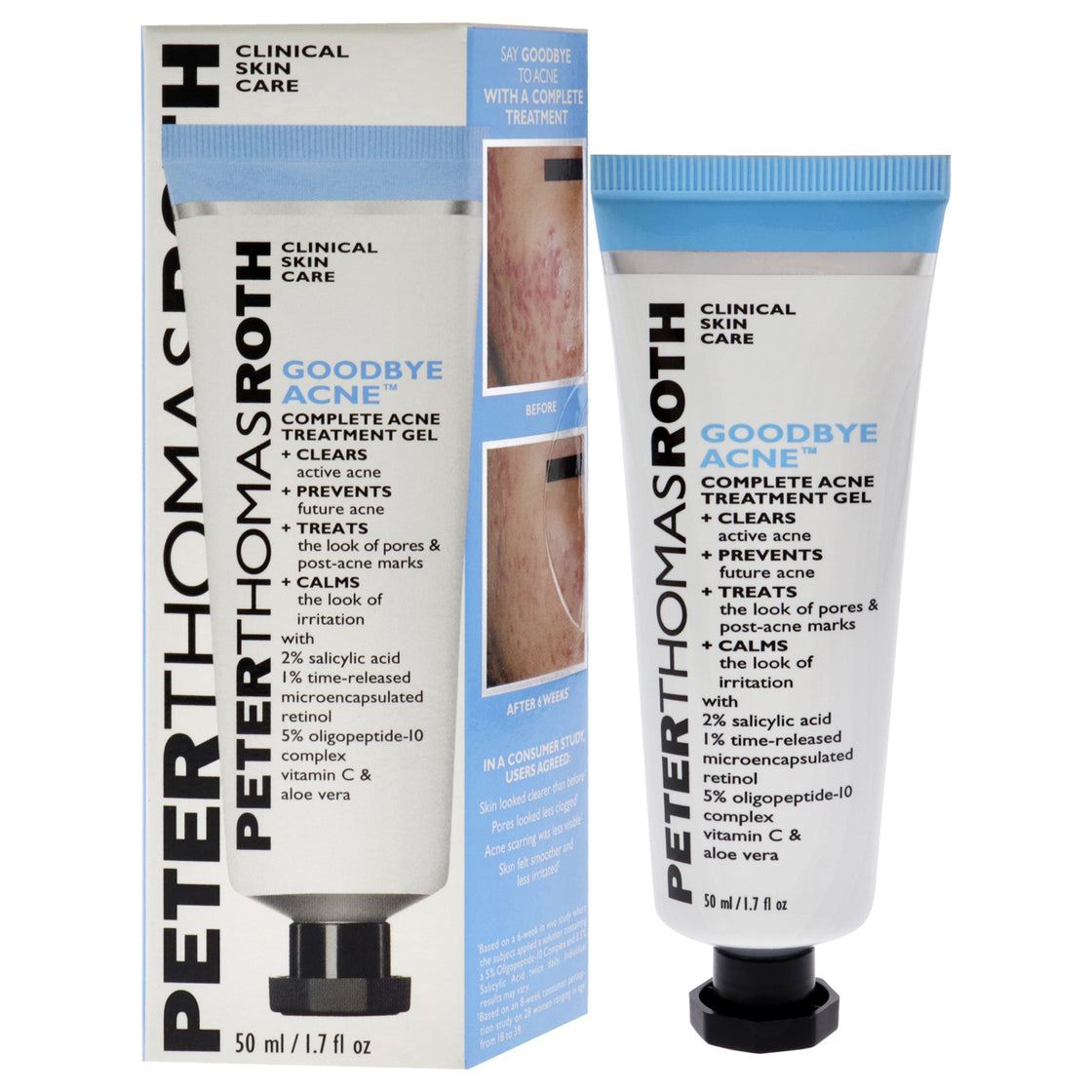 Good Bye Acne Complete Treatment Gel by Peter Thomas Roth for Unisex - 1.7 oz Treatment